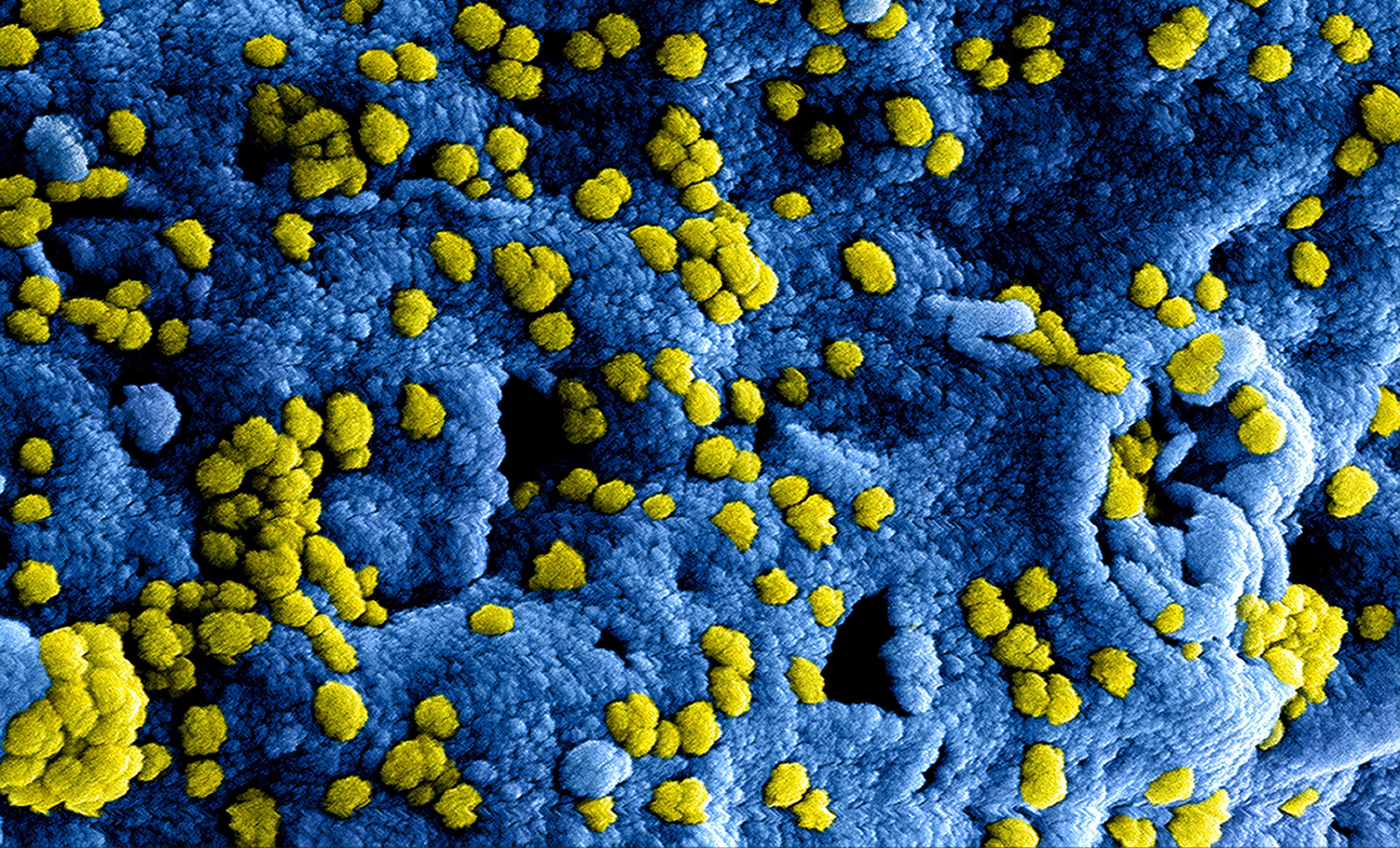 a microscopic view of a pathogen